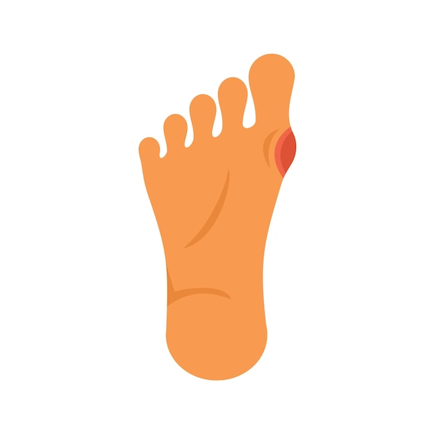 人腳經歷痛苦的 hallux valgus 狀況