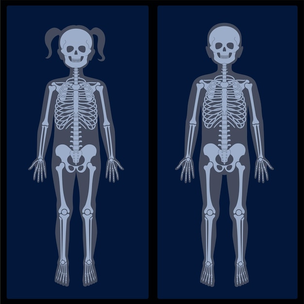 Human girl and boy skeleton pain, fracture or inflammation on x ray view vector  illustration