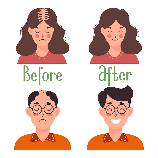 Human hair transplant Woman and man before and after transplantation Health care and medicine