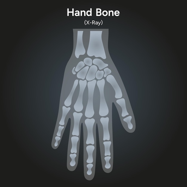 Human hand bone xray