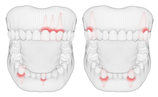 Mascella umana 3d layout medicina e salute denti di dolore