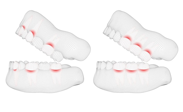 Human jaw. 3d vector layout. medicine and health. pain teeth.