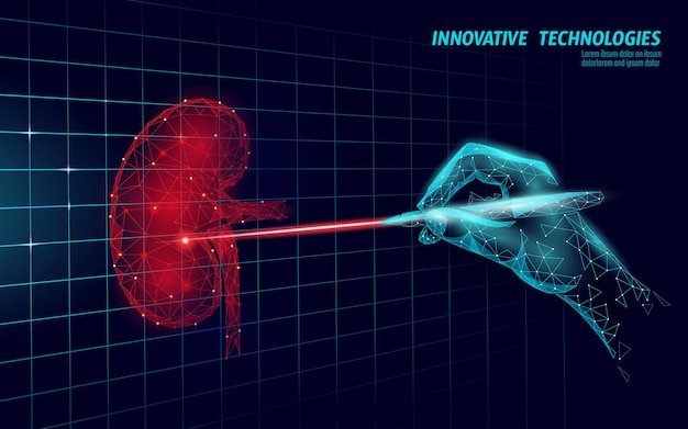 Reni umani chirurgia laser operazione low poly