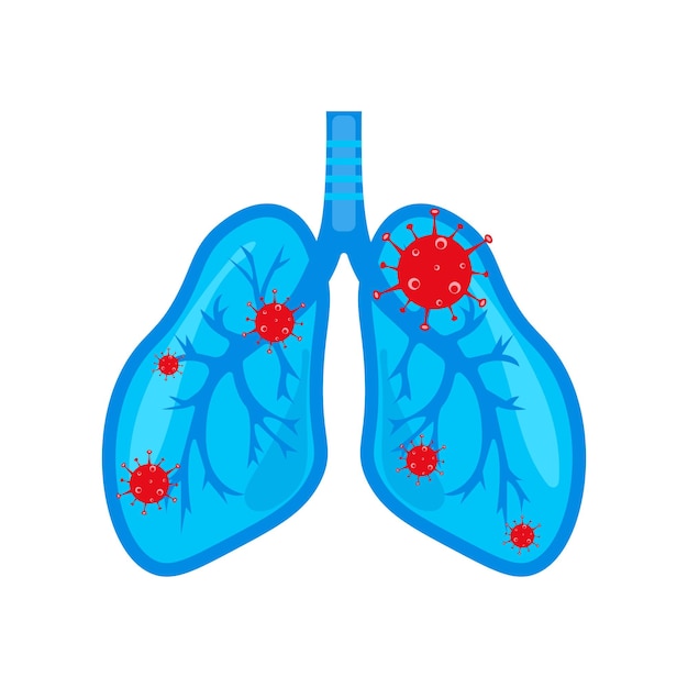 Human lungs affected by the virus