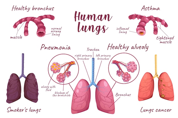 Vector human lungs d realistic set vector illustration isolated elements
