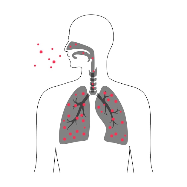 벡터 바이러스 감염 질병과 코로나바이러스 전염병 개념이 있는 인간의 폐