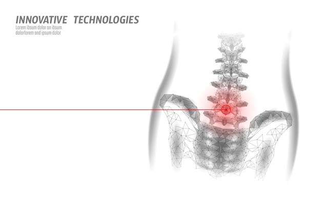 人間の背骨腰腰神経根炎の痛み低ポリ。