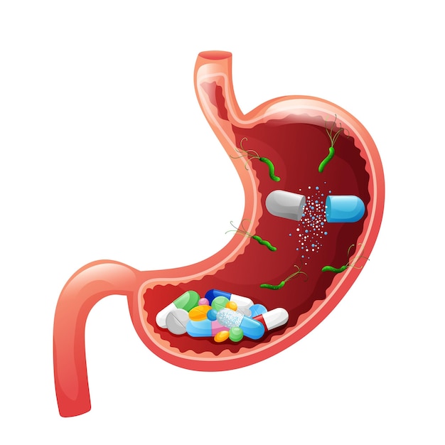 Stomaco umano con capsule di farmaci, compresse, pillole e helicobacter pylori all'interno