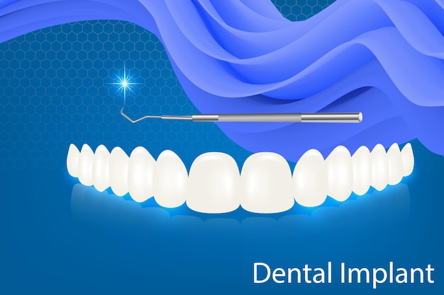 Human teeth and dental implant vector illustration