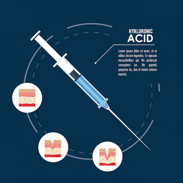 Hyaluronic acid filler injection infographic