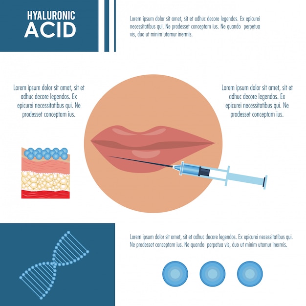 Hyaluronic acid filler injection infographic