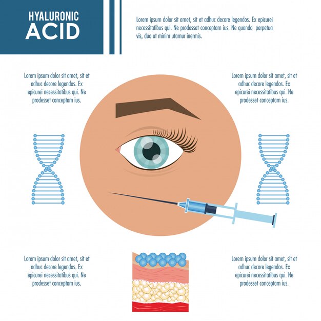 Hyaluronzuur vulmiddel injectie infographic