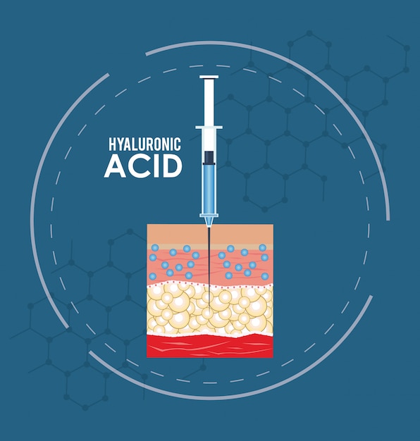 Hyaluronzuur vulmiddel injectie infographic