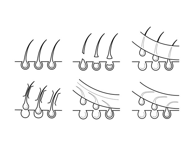icons of hair removal methods