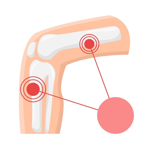 Vector illustratie van bot