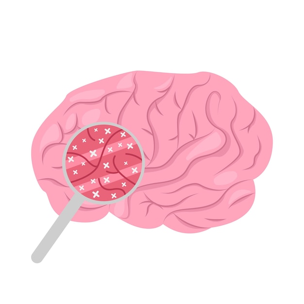 Illustratie van de hersenen