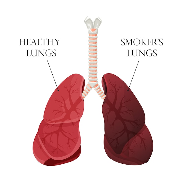 Illustratie van normale gezonde longen en longen roker Concept van stoppen met roken Vectorillustratie