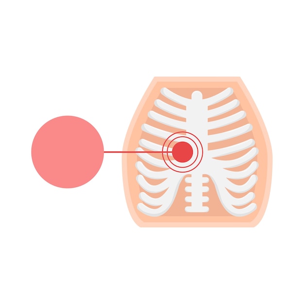 Illustration of bone