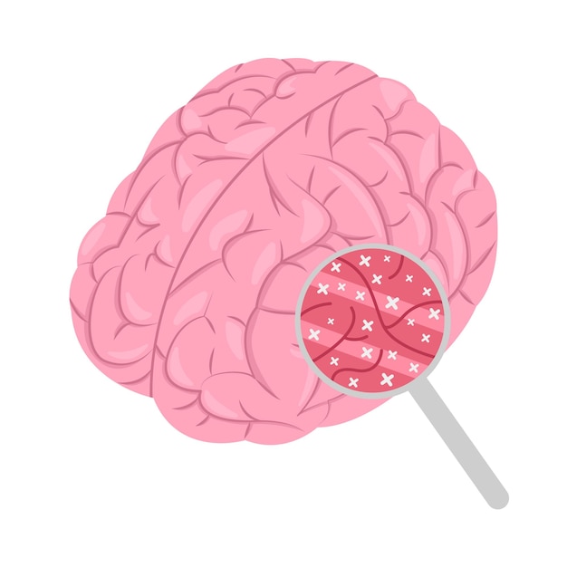 Illustration of brain