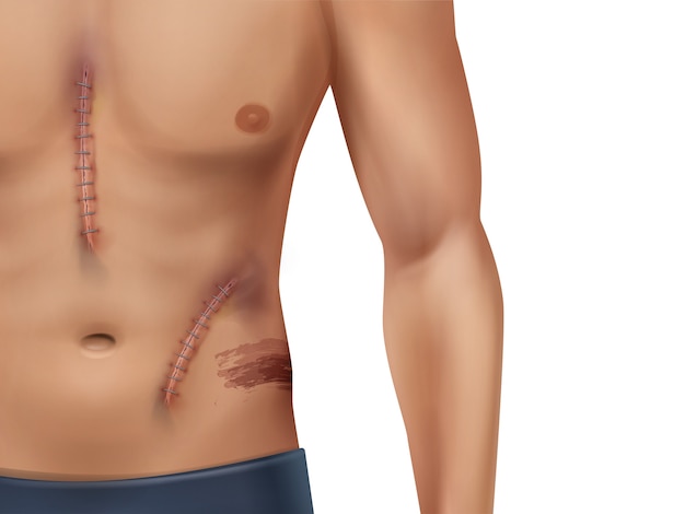 Vector illustration of caucasian man torso with lot of scars