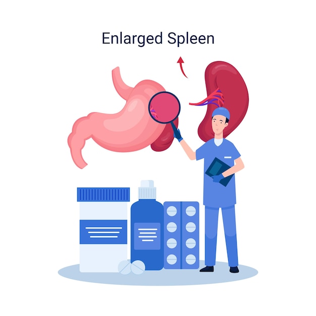 Illustration disease splenomegaly, enlarged spleen