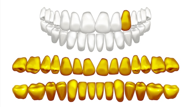 Vector illustration of golden teeth set