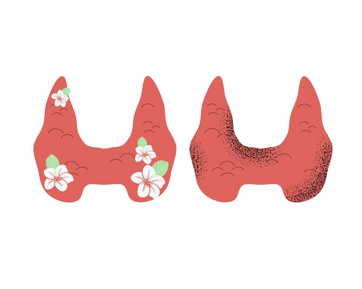 Vector illustration of healthy and diseased thyroid gland good and bad endocrine function medical
