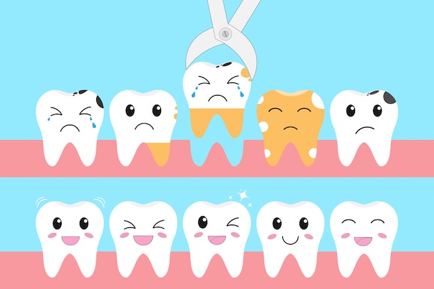 Illustration icon set of healthy teeth and problem of tooth loss