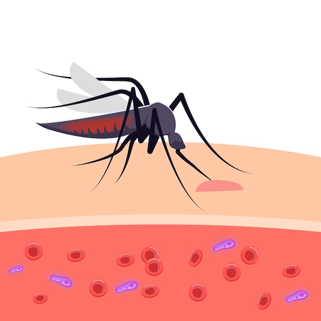 Vector illustration mosquitoes bite the skin and infection parasites