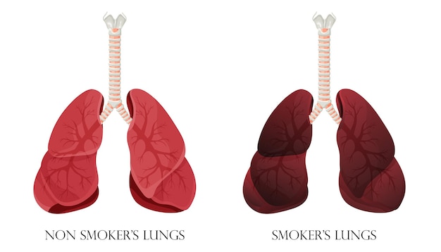 正常な健康な肺と肺喫煙者のイラスト禁煙の概念ベクトルイラスト