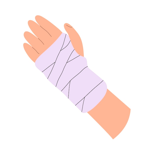 Illustration of plaster bondage on a broken arm