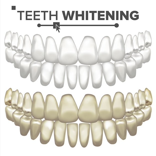 Illustration of teeth set