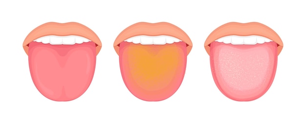 Illustration of tongue symptoms and health medical illustration