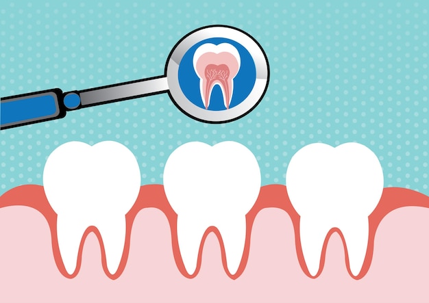 Illustrazione del dente