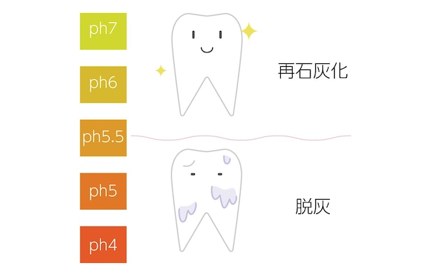 재광화 및 탈광화의 pH 값에 대한 이미지 삽화xATranslation 재광화 탈광화