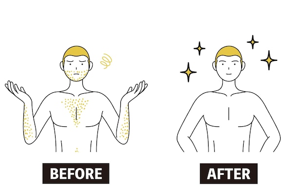 Изображение медицинской эпиляции до и после мужчины с густыми волосами на теле, который становится более уверенным в себе после удаления волос