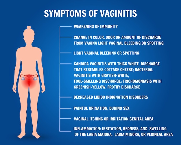 Infographic of symptoms of vaginitis in vector illustration