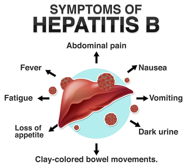 Vector informatieve symptomen van hepatitis b