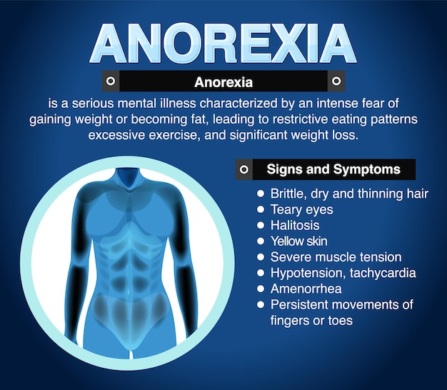 Vettore poster informativo del disturbo alimentare dell'anoressia