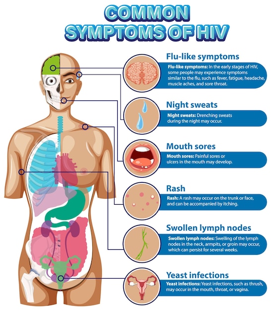 Vector informative poster of common symptoms of hiv