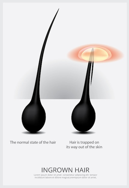 Vettore illustrazione della struttura dei capelli incarniti