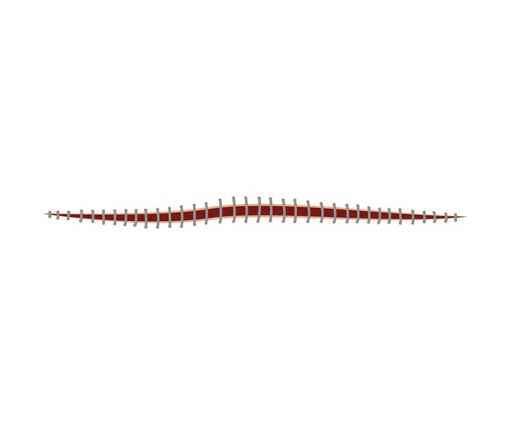 Vector injury treatment with help simple interrupted lembert suture represented horizontally medical concept