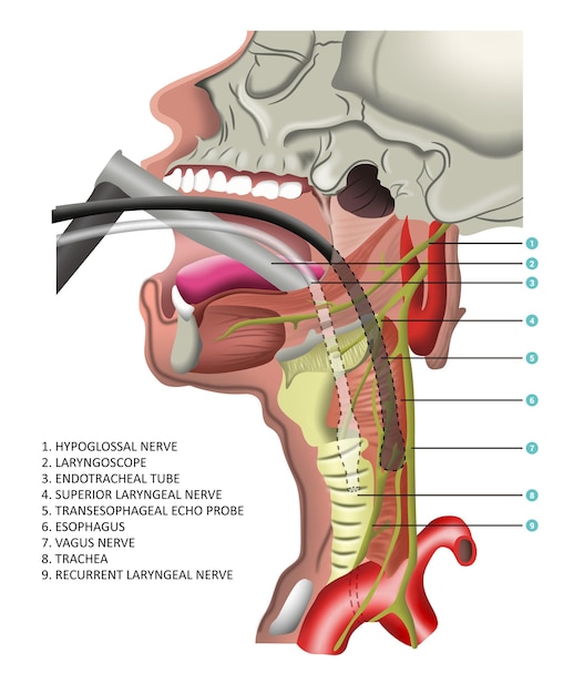 Vector intubatie