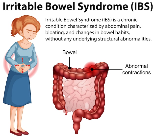 Irritable bowel syndrome ibs infographic