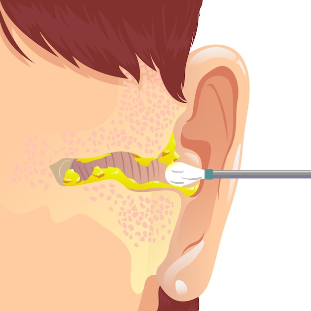 Vector irty ear with earwax