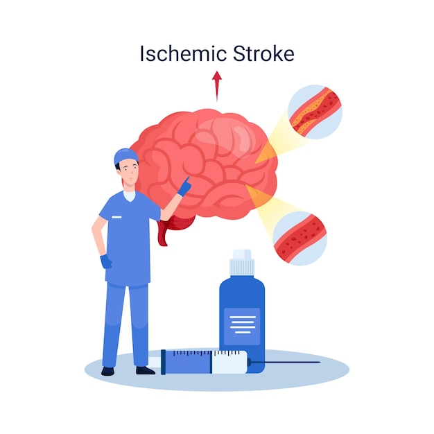 Vector ischemic stroke disease concept illustration