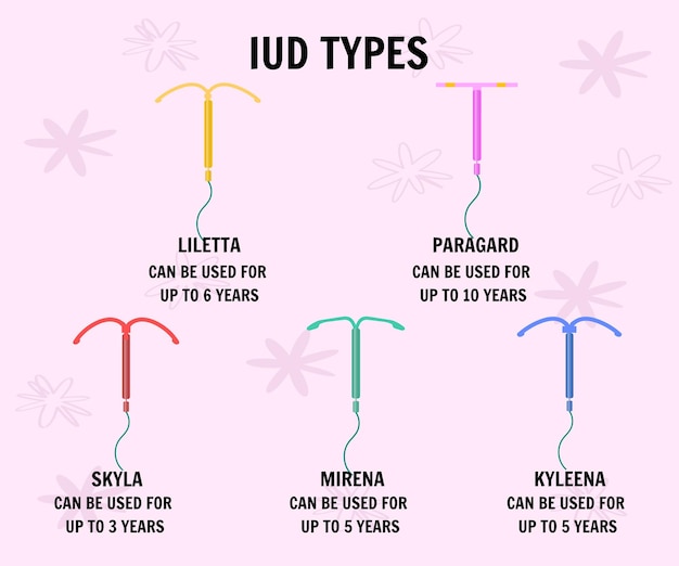 Iud spiraaltje typen in vector