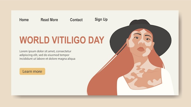 Jonge blanke meid illustratie met vitiligo banner Wereld Vitiligo Dag Rood haar cartoon vrouw