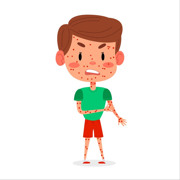 Vector kid boy has chickenpox or measles disease. red rash on children body  illustration