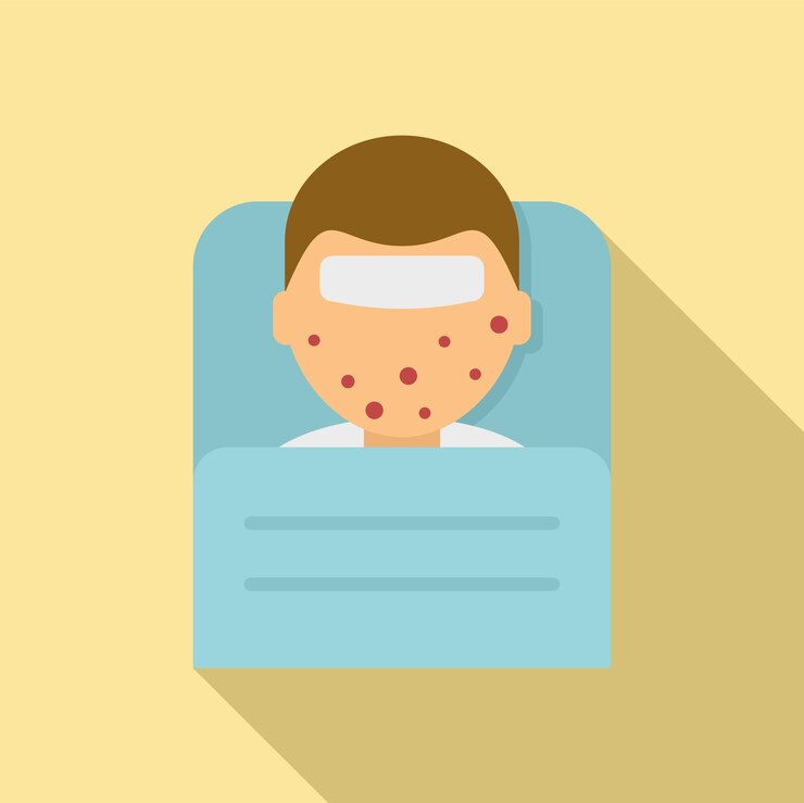 Vector kid measles icon flat illustration of kid measles vector icon for web design